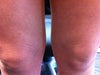 Knees