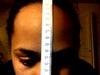 Straight down the middle. About eight cm from the start of my hairline to my brow.