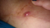 closer but no better image. sry.