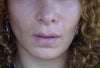 my face now