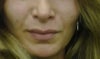my face now