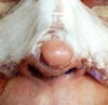 front view- asymmetry