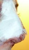 side view: visible bulge in the right nostril