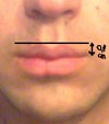 this is the ideal line of my mouth.