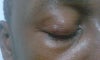 The second eye