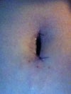 BB today- I can tell it is also getting more constricted.