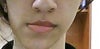the normal closed mouth