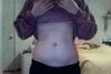 Before Front