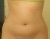 8 weeks later