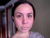 Frontal view on a swollen/bad day