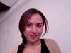 Frontal view with slight make-up, less noticeable V but looks slightly off center and swollen.