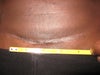 skin is depressed causing "pinned" effect