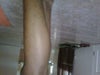 Dark sots on my left left