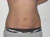front abdomen