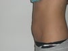 side abdomen