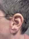 Left Ear