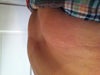 Side profile - First thing in the morning.  I have not eaten anything, once I do I will look 5 months pregnant. I do not celiac disease. Notice how pubic area is extended (again I have not eaten anything). Most people,no matter how over weight do not seem to have this.