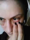 Left eye, doing good!