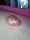 this is between my neck and shoulder