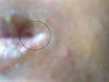 I have marked the affected area by oval icon