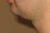 neck and jowls