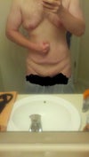Will loosing more weight after Gyneo Surgery affect results signficantly? Would like to loose more for my TT about 6 mos after Gyneo surgery.