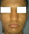 Front view (flash)
