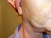 can really see the rake marks and swelling/hematoma in the neck area