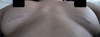 Laying down I have a 4-5 finger gap