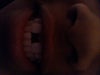 My bottom teeth are completely straight how can I fix this as you can see its a fairly large gap