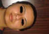 Frontal view