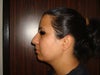 Lateral View2