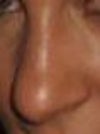 Nose side profile
