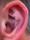 Left ear