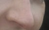 what i dislike about my nose: side, 3/4 view bumpy/ over projecting