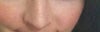 "after" computer imaging - hopefully my rhinoplasty result?