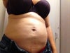 I had my abdomen and flanks done. Can see major lumps, tires (under bra line) and unevenness all over belly (wore garment for 6 weeks!) Can also see areas where he was too aggressive (under belly button and on flanks). Scars never disappeared after 2 years