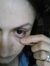 Left eye looks normal.