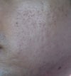 direct sunlight