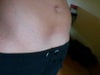 when I flex my lower abs its turning into a gap in the lower ab