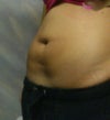 when I slightly bend backwards  there is a gap and a bulge on each side