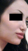5 months after