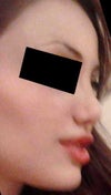 6 months after