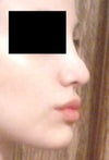9 months after