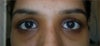 my eye image.