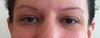 Multiple wrinkles noticeable.