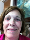 Rt side of mouth doesn't function correctly when smiling or speaking May 29, 2012