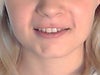 This is my smile.