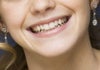 I wish my smile was like this. Could I get anywhere remotely close?
