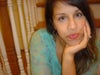 This is 6 months post SARPE but still with braces and springs (behind my bottom lip)